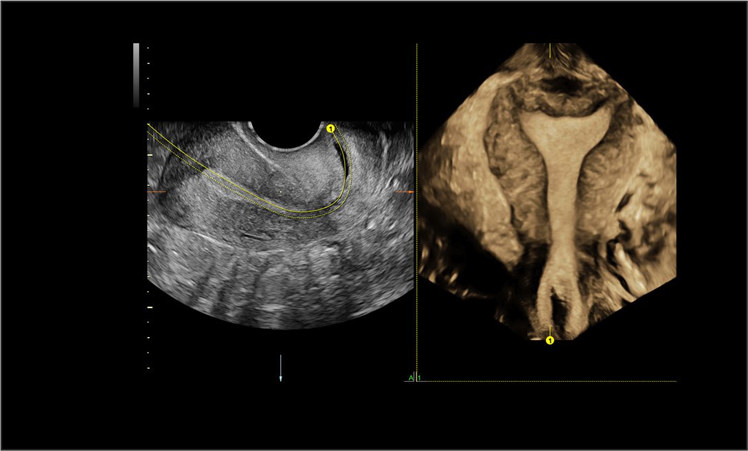 PREGNANCY SCANS AND 3D-4D IMAGING