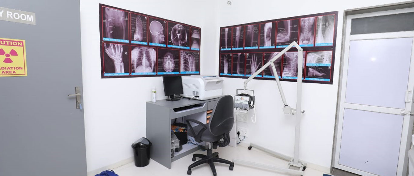 Mobile X-Ray Room