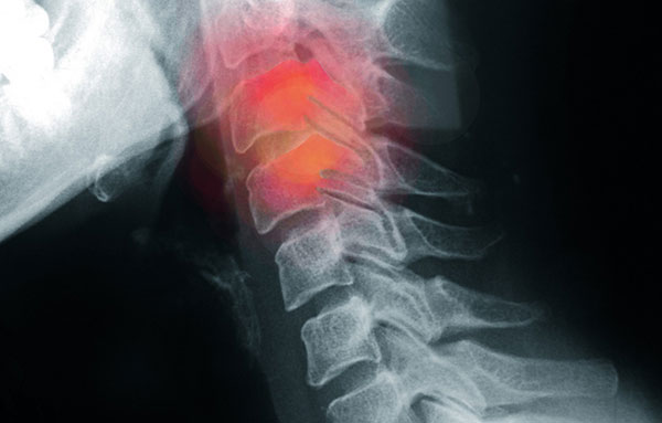 WHAT IS AN X-RAY?